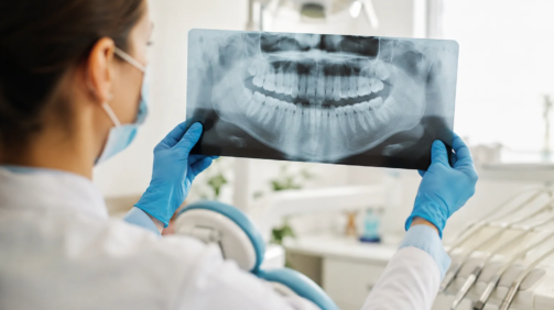 How Often Should Dental X-Rays Be Taken