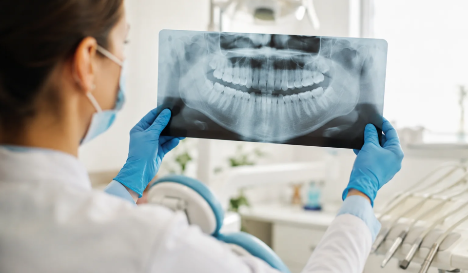 How Often Should Dental X-Rays Be Taken