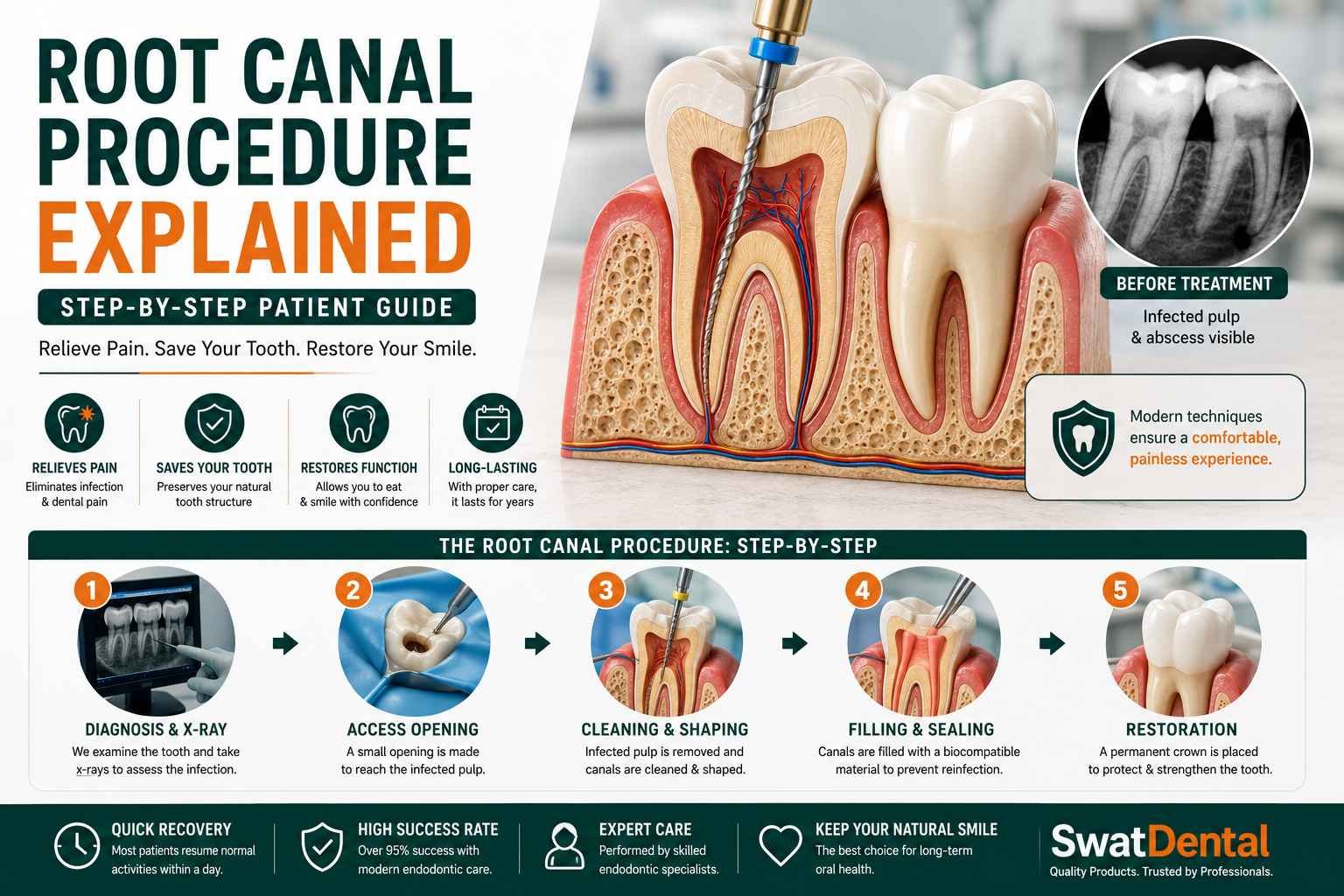 Root Canal Procedure Explained: Step-by-Step Patient Guide